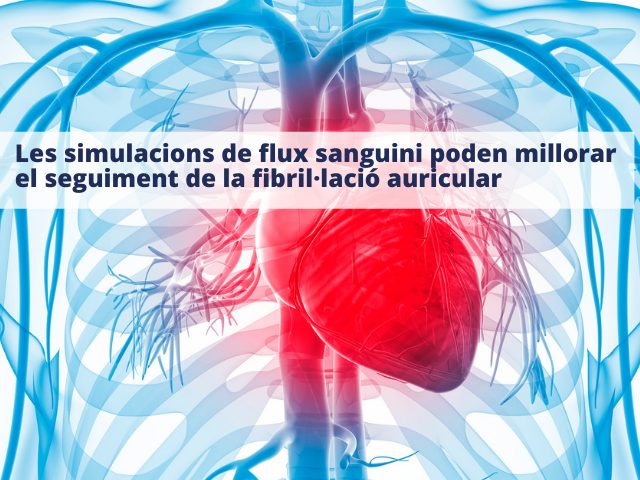 Les simulacions de flux sanguini poden millorar el seguiment de la fibril·lació auricular